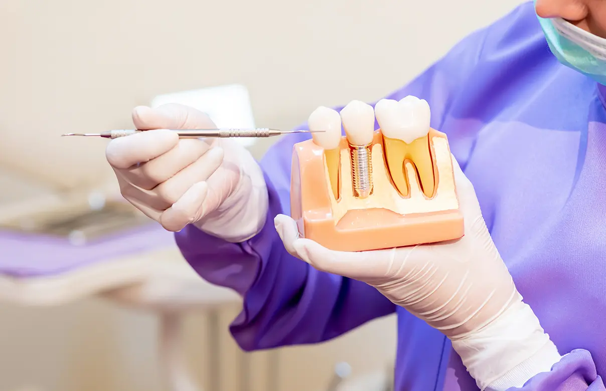 当院のインプラント治療