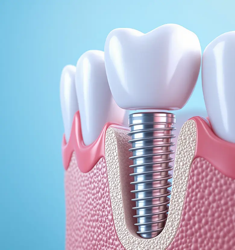 骨の少ない方への治療