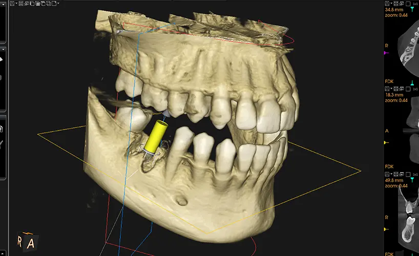 ガイデッドサージェリー