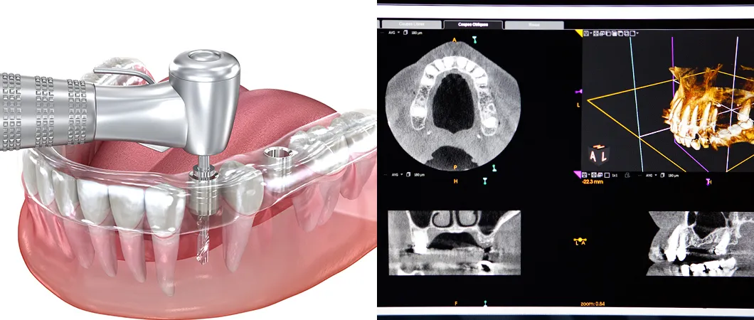 ガイデッドサージェリーシステムとは